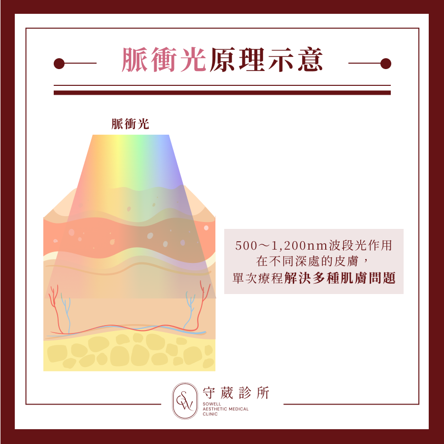脈衝光原理示意